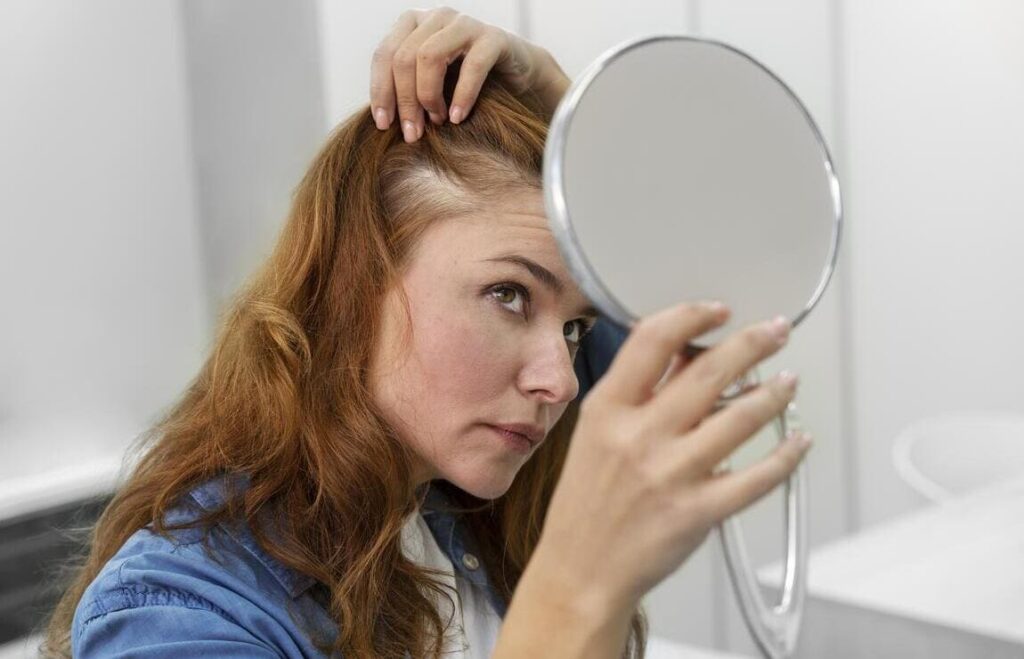 O que é alopecia?